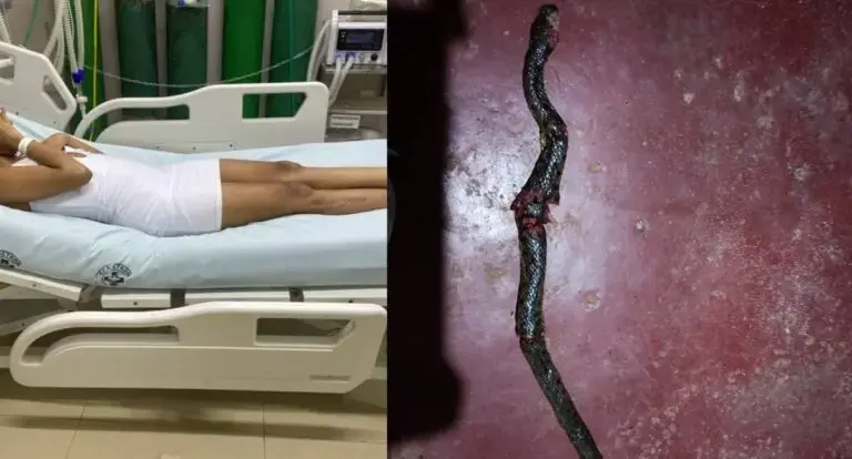 Mulher é picada por jararaca na Estrada de Ferro em Porto Velho