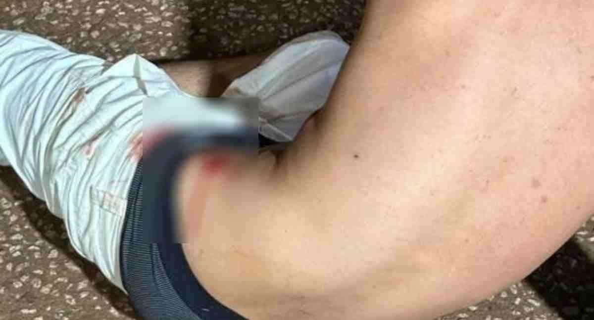 Homem de 22 anos é encontrado ferido depois de possível agressão em Porto Velho