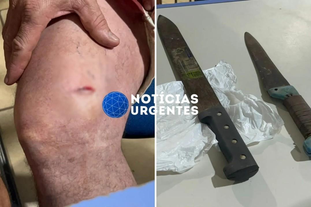 Comerciante é esfaqueado ao tentar separar briga entre bolsonarista e petista