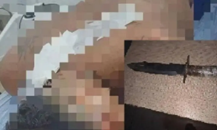 Briga entre irmãos encerra com homem ferido por facada e paulada em município de Rondônia