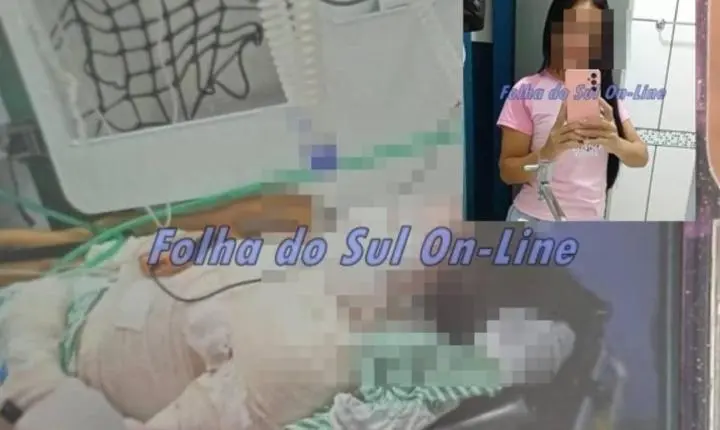 Mulher de 42 anos despeja acetona no próprio corpo e ateia fogo em Rondônia