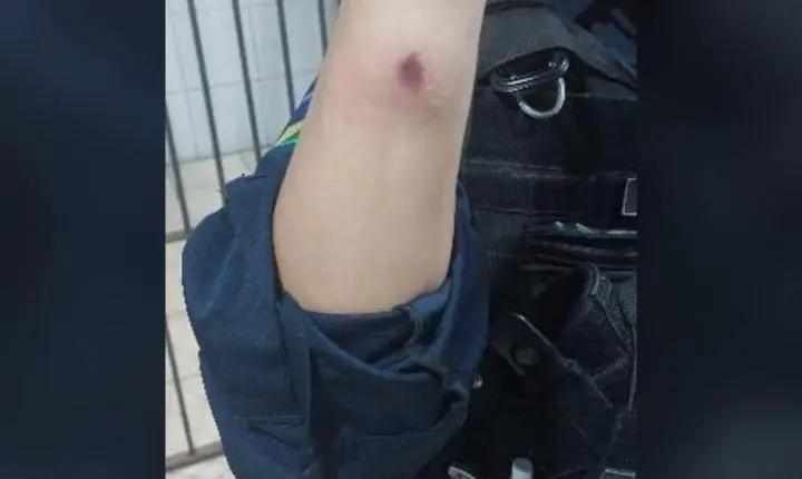 Policial Militar é atacado a mordidas durante registro de ocorrência na zona leste de Porto Velho